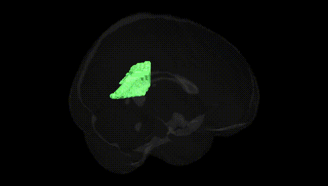 Full Brain Black