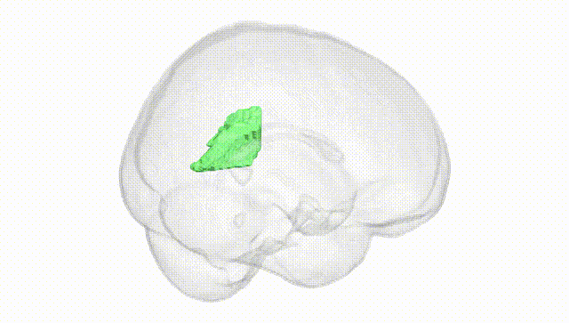 Full Brain White