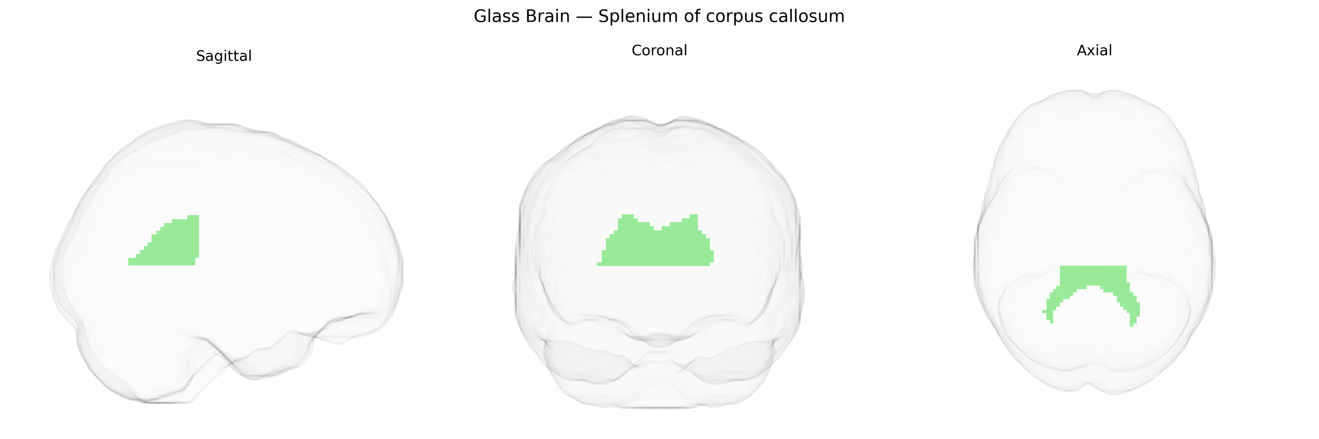 Triplanar Ghost Brain