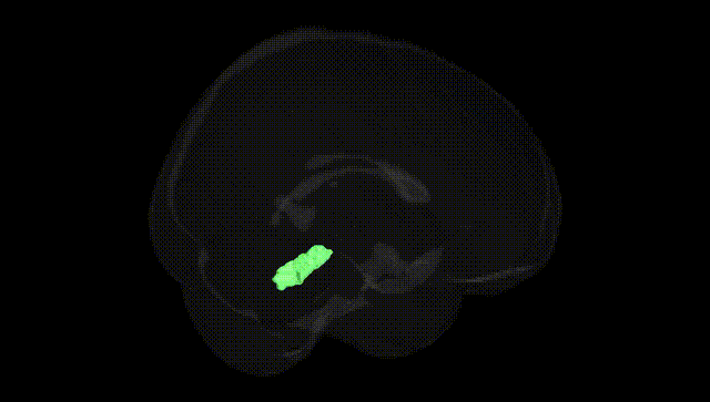 Full Brain Black