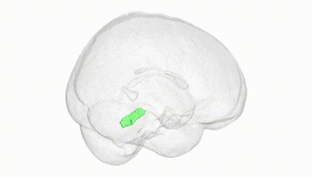 Full Brain White