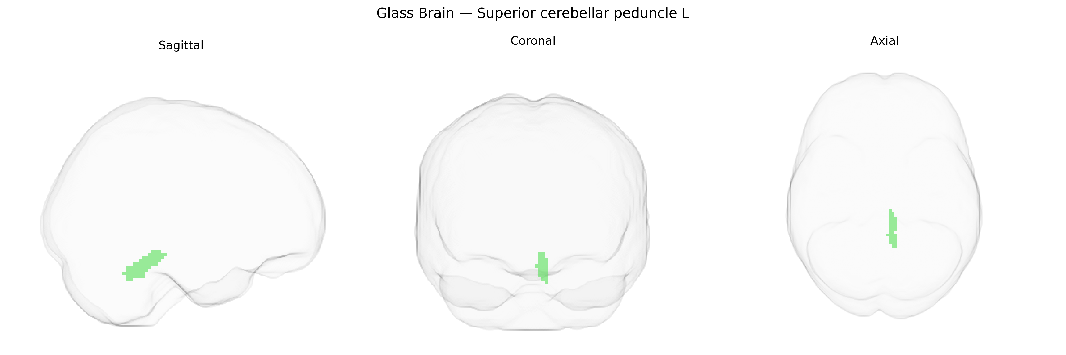 Triplanar Ghost Brain