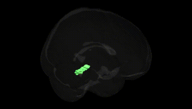 Full Brain Black
