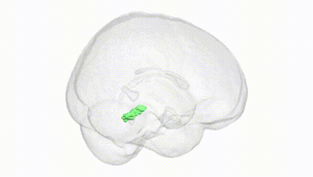 Full Brain White