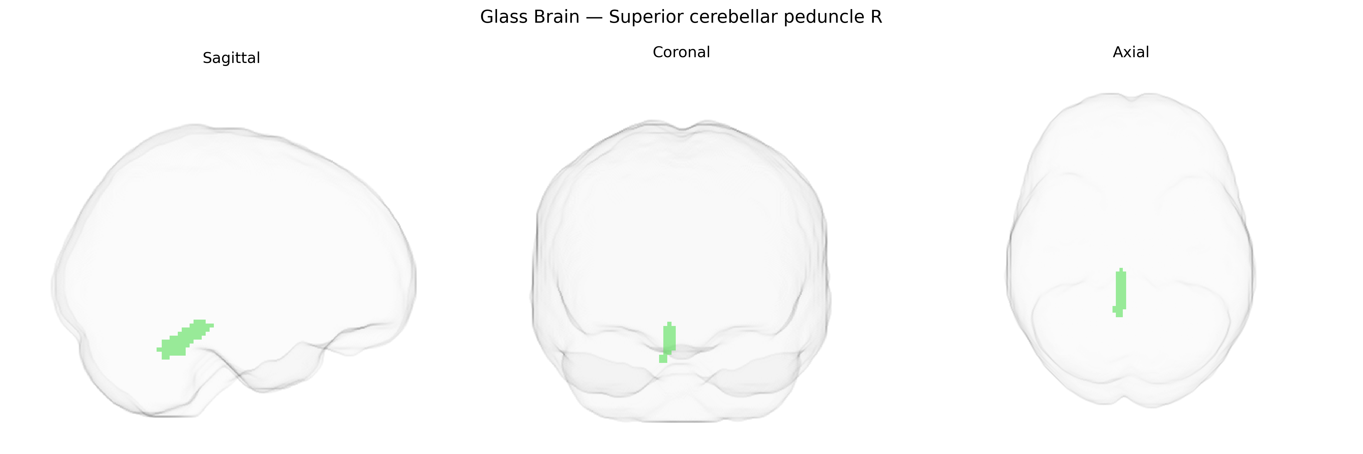 Triplanar Ghost Brain