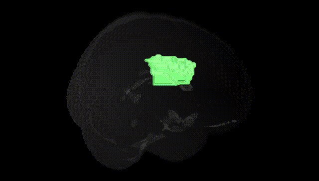 Full Brain Black