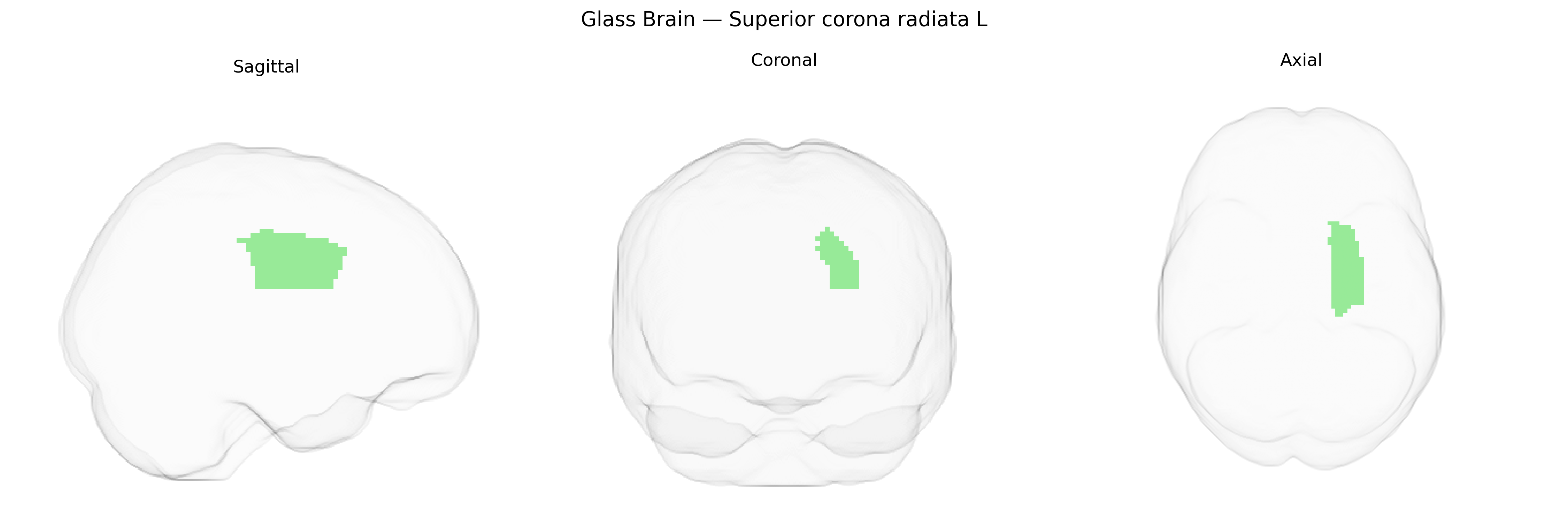 Triplanar Ghost Brain