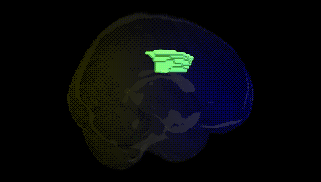 Full Brain Black