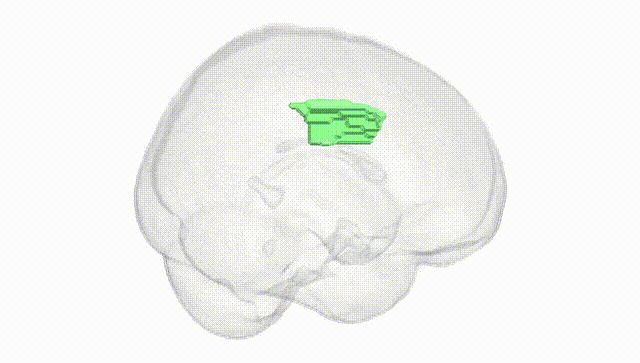 Full Brain White