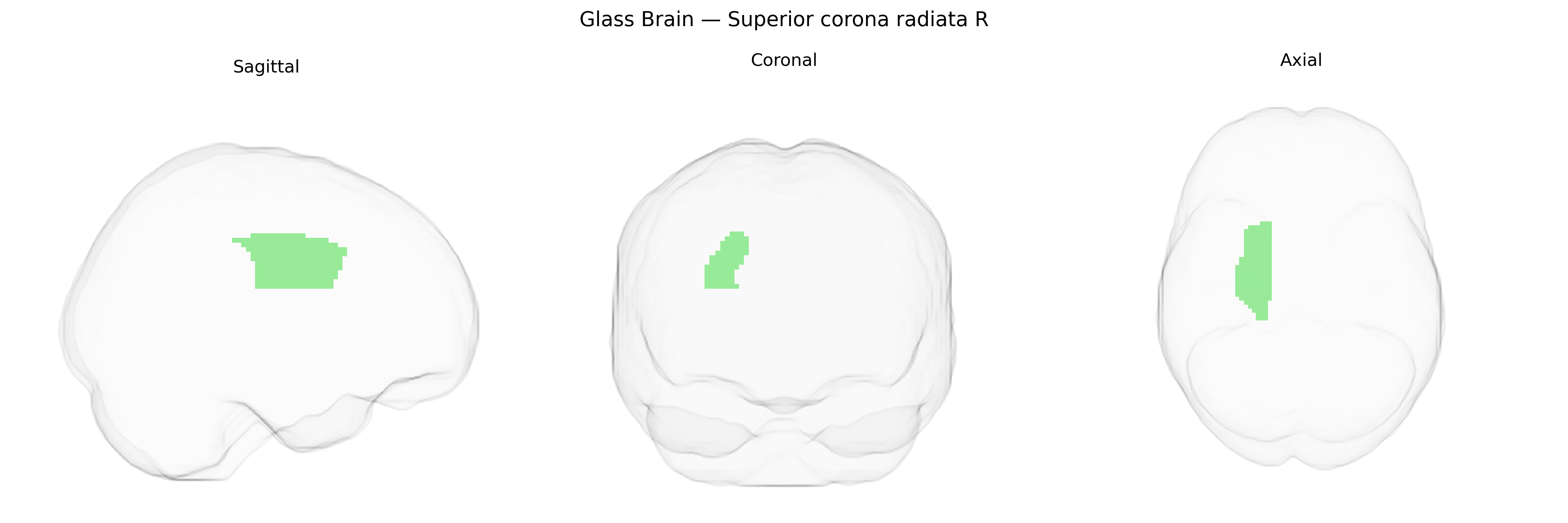 Triplanar Ghost Brain
