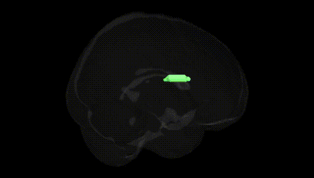 Full Brain Black