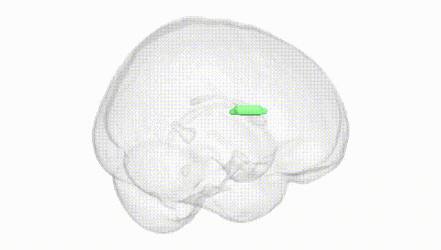 Full Brain White