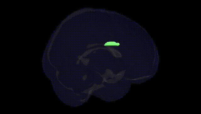 Full Brain Black