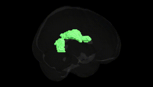 Full Brain Black