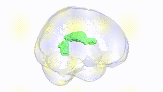 Full Brain White