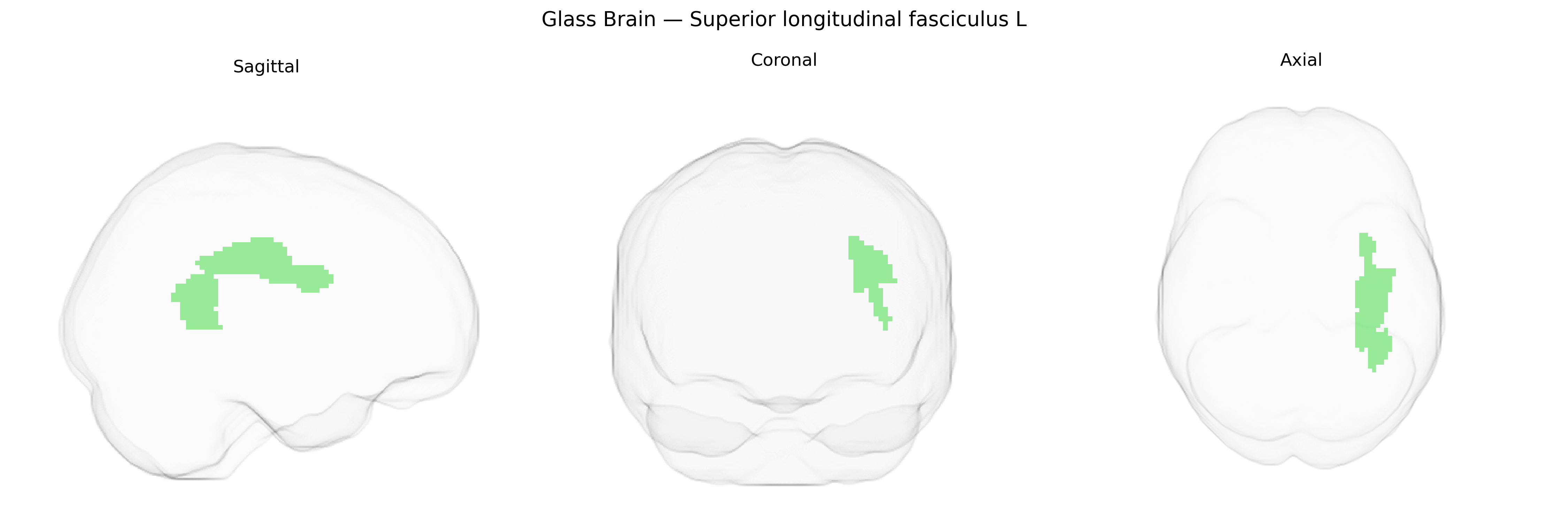 Triplanar Ghost Brain
