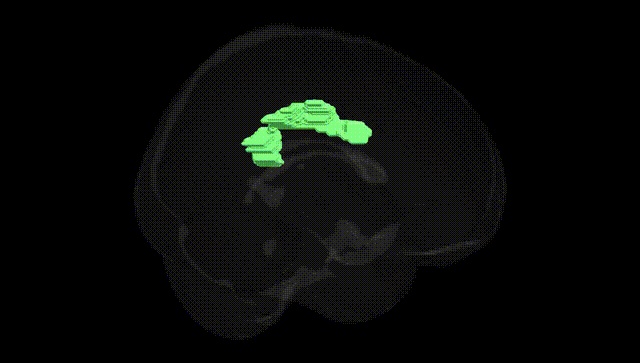 Full Brain Black