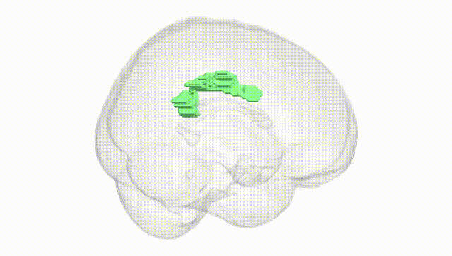 Full Brain White