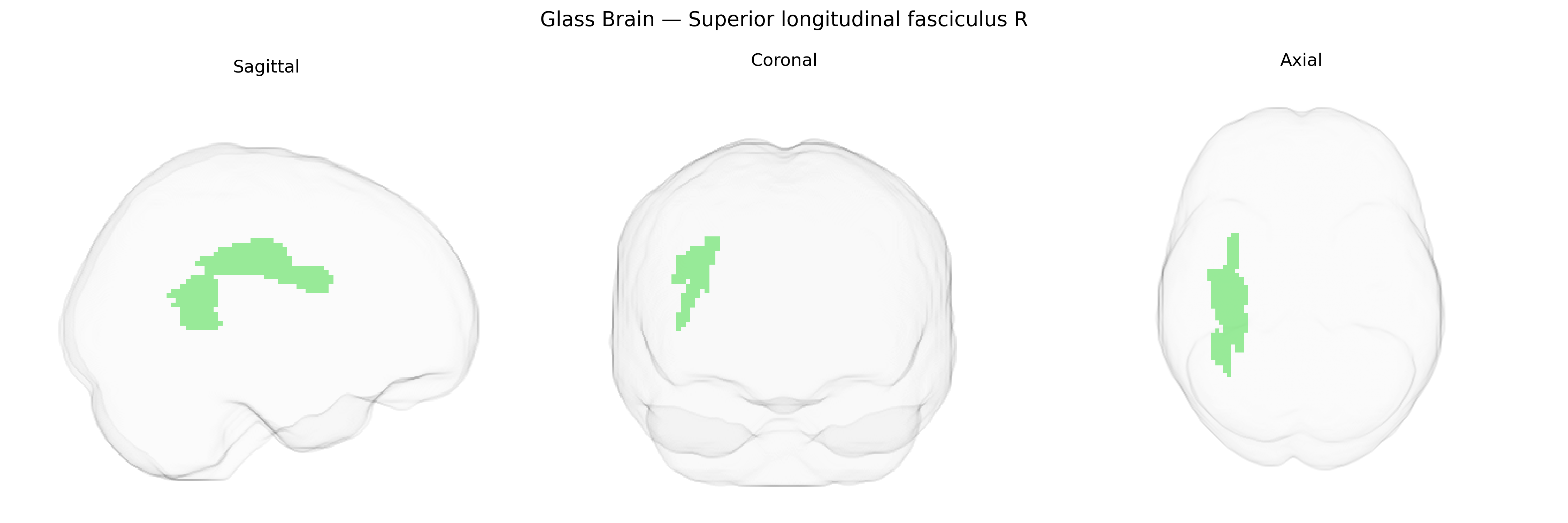 Triplanar Ghost Brain