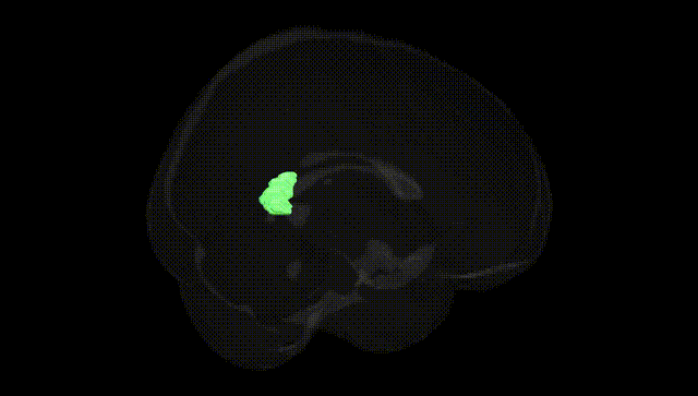 Full Brain Black