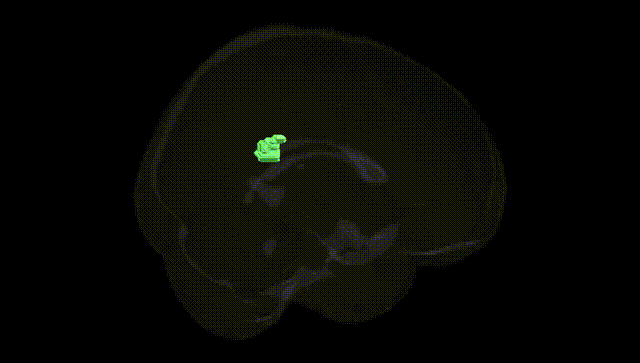Full Brain Black