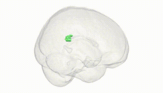 Full Brain White
