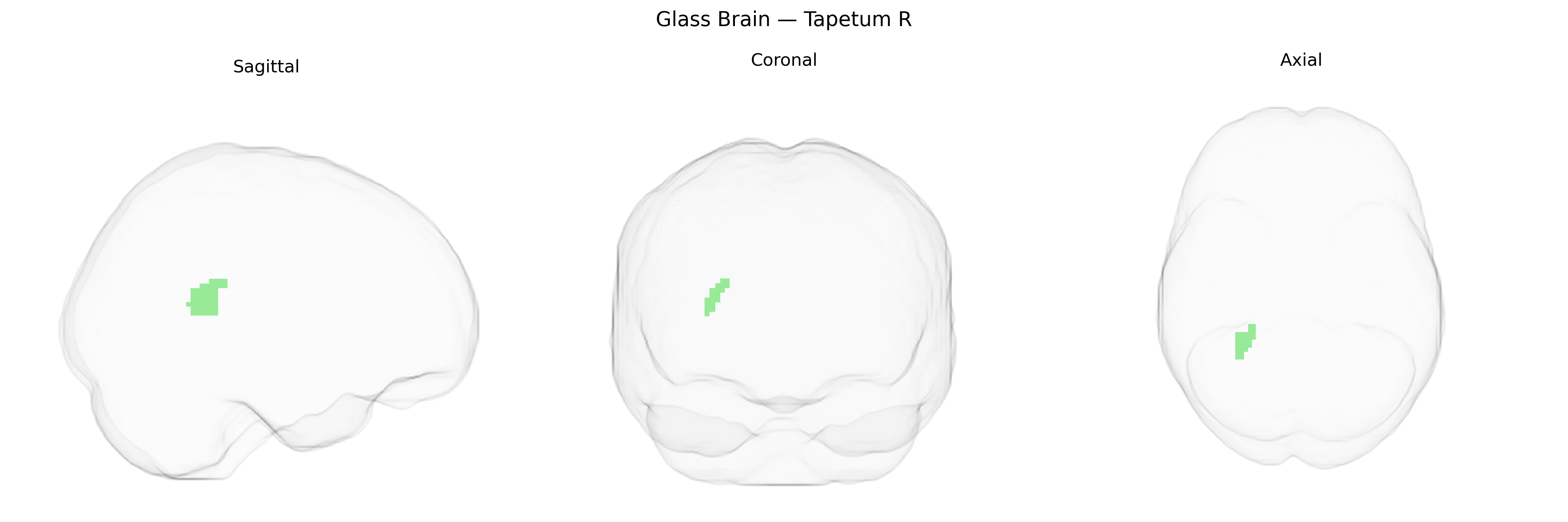 Triplanar Ghost Brain