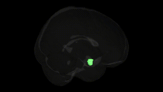 Full Brain Black