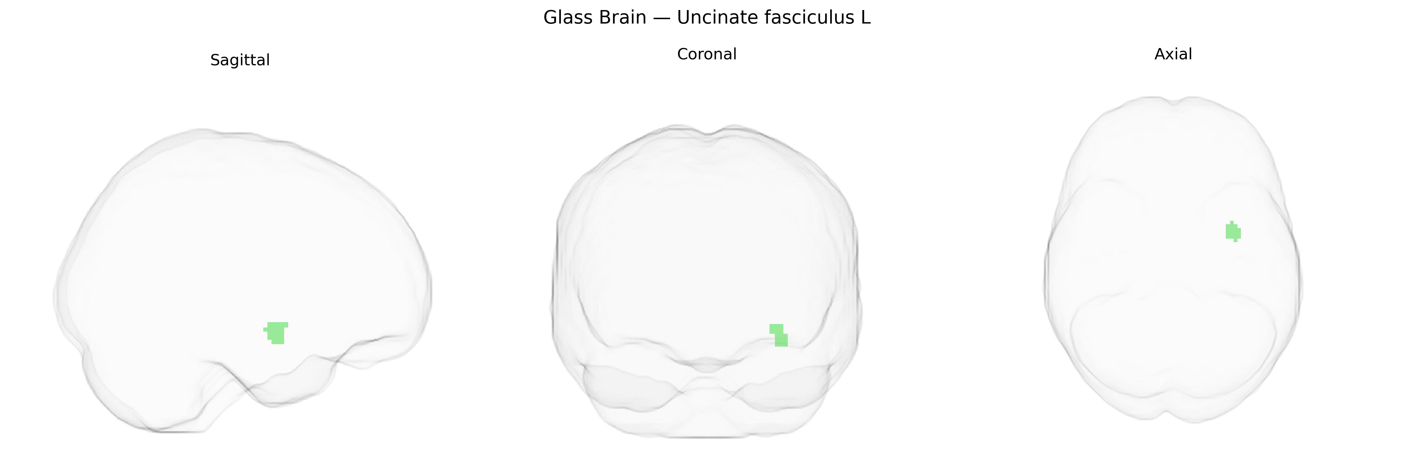 Triplanar Ghost Brain