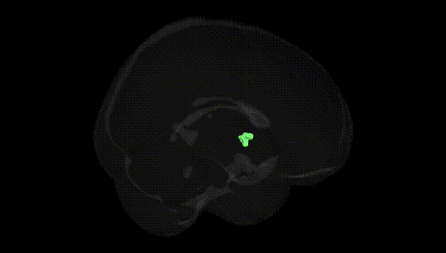 Full Brain Black