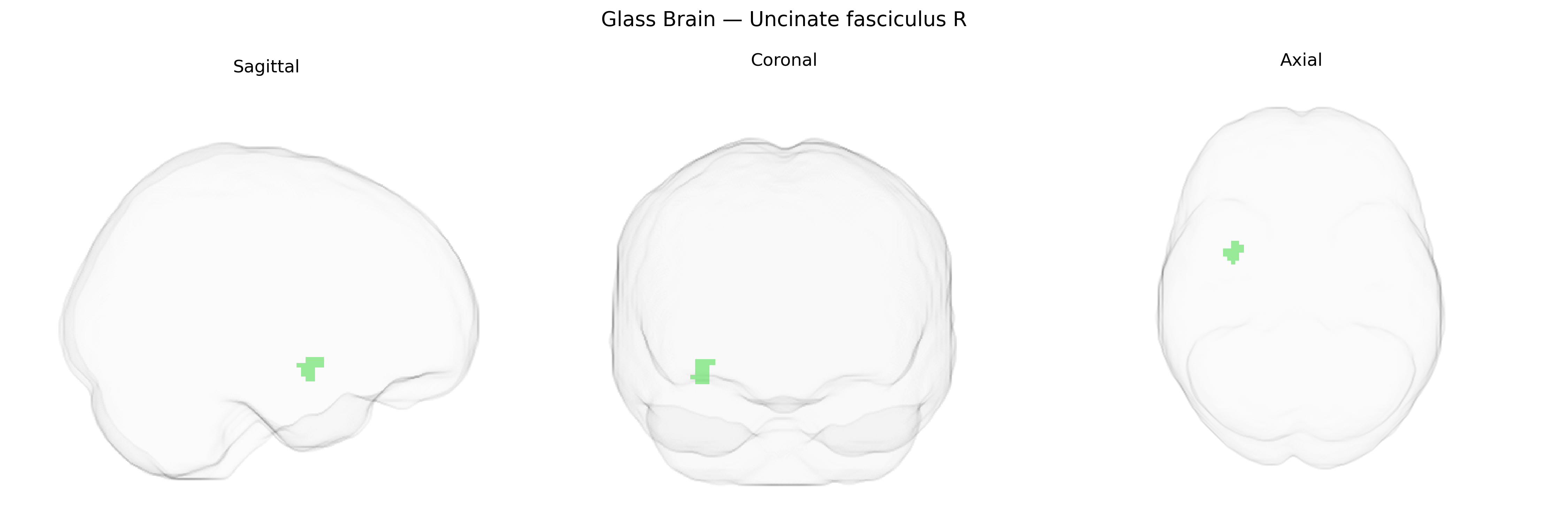 Triplanar Ghost Brain
