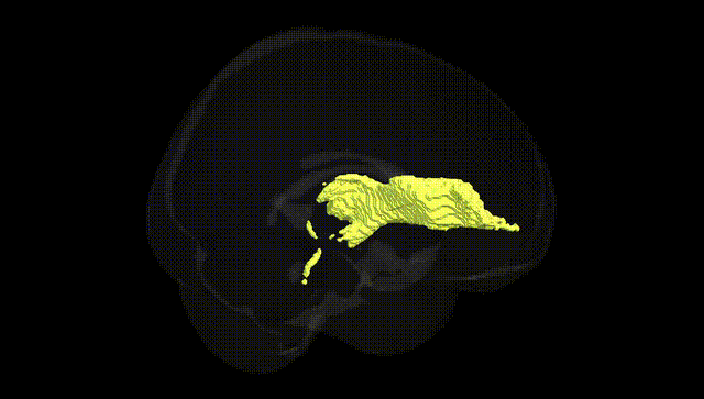 Full Brain Black