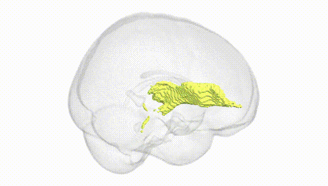 Full Brain White