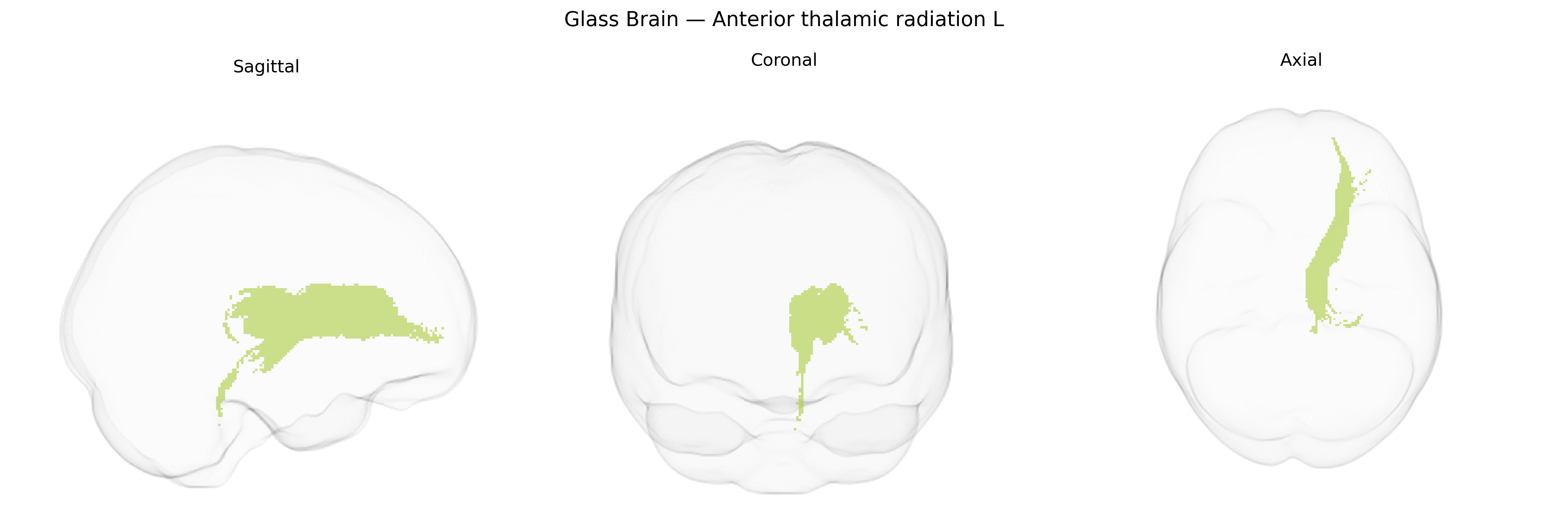 Triplanar Ghost Brain
