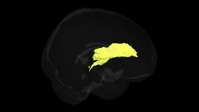 Full Brain Black