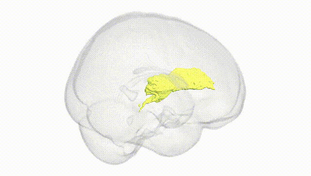 Full Brain White