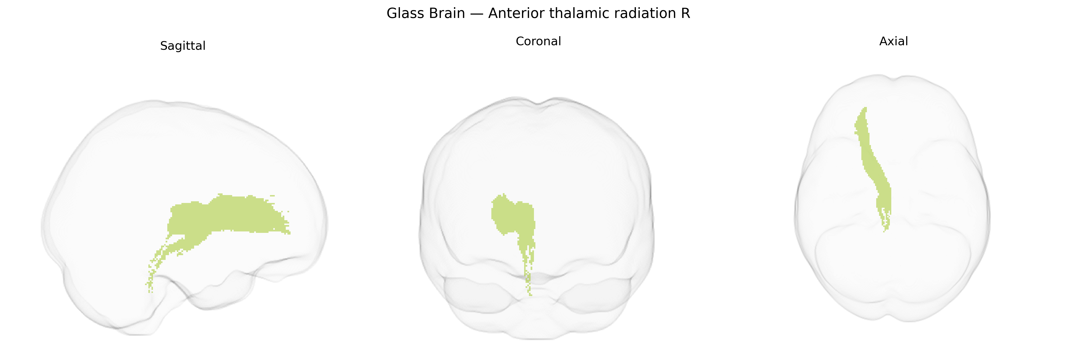 Triplanar Ghost Brain