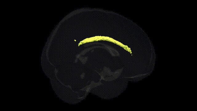 Full Brain Black