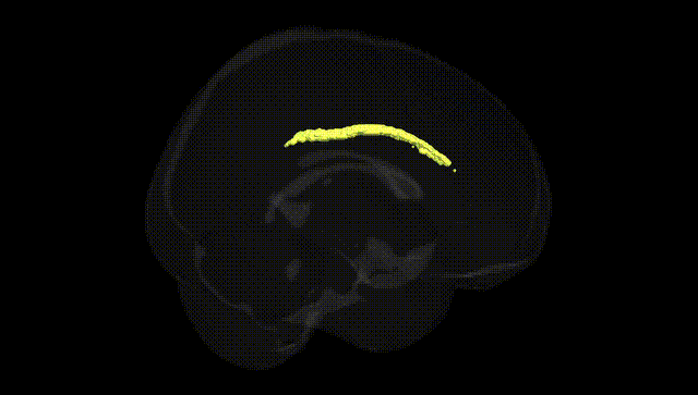 Full Brain Black