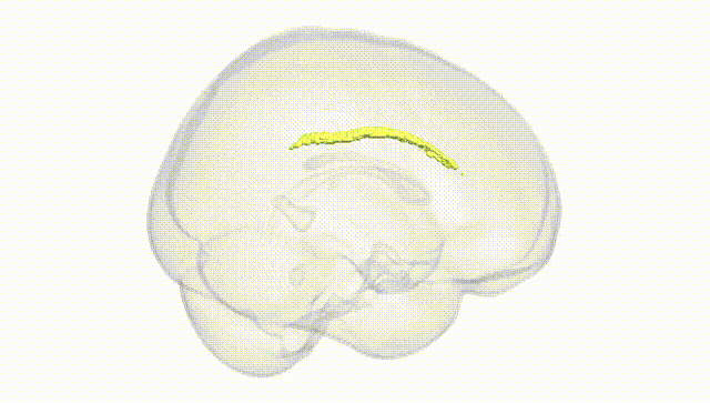 Full Brain White