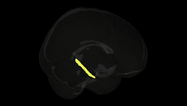 Full Brain Black