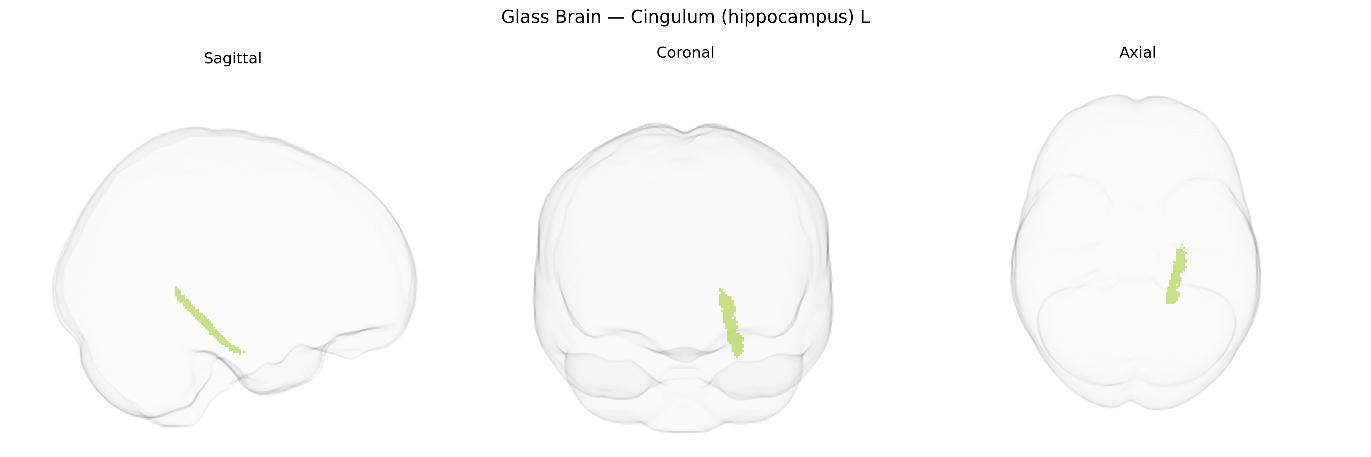 Triplanar Ghost Brain