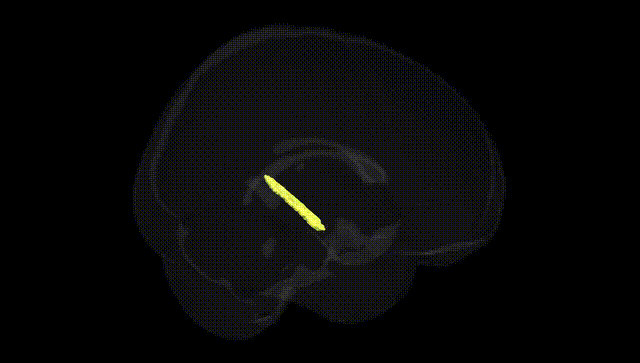 Full Brain Black