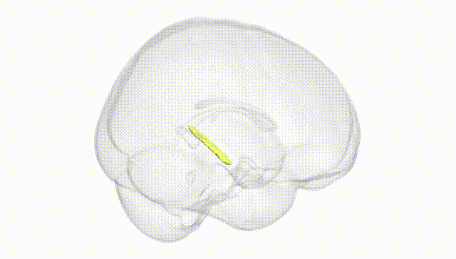 Full Brain White