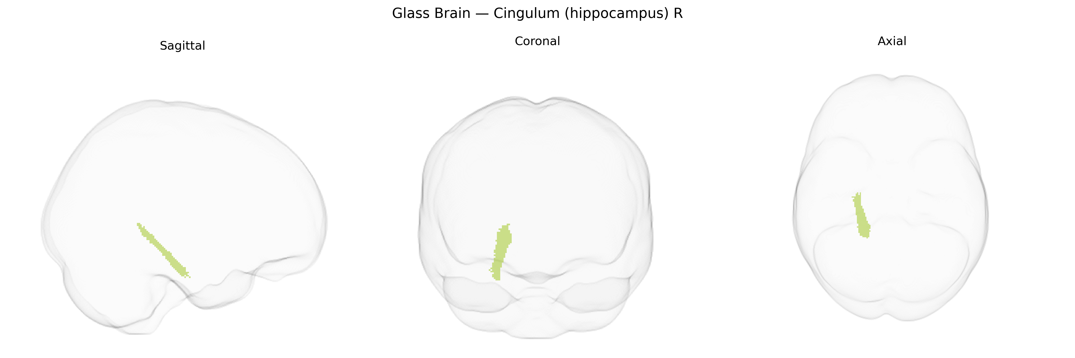 Triplanar Ghost Brain