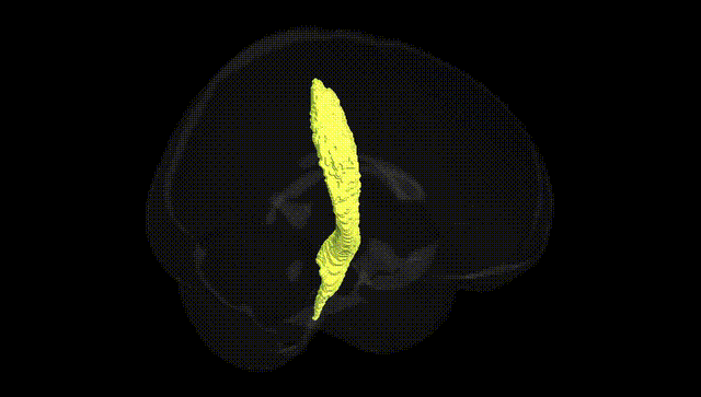 Full Brain Black