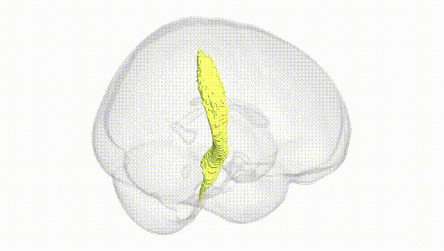 Full Brain White