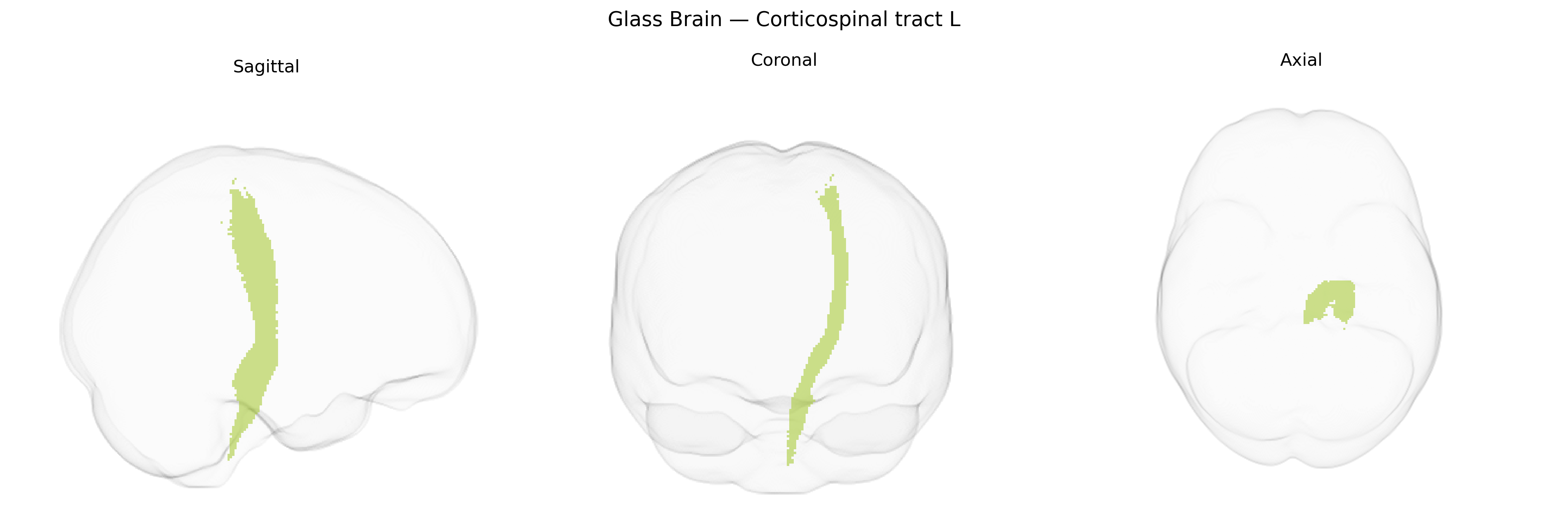 Triplanar Ghost Brain