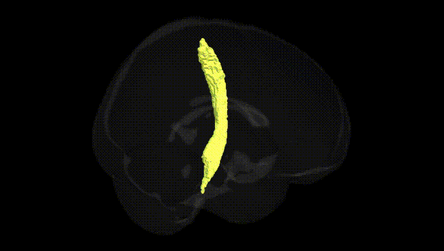 Full Brain Black