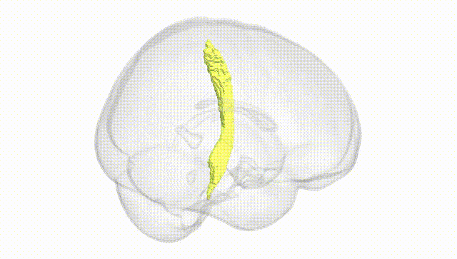 Full Brain White